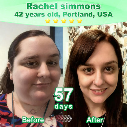 𝐃𝗼𝗰𝐭𝗼𝗿 𝗥𝗲𝐜𝗼𝗺𝗺𝐞𝗻𝗱𝐞𝗱👩‍⚕️| 𝙇𝒐𝒕𝐦𝒂𝘆®  𝑮𝗟𝑷-1 𝟔-𝗶𝙣-𝟏 𝙊𝙧𝒂𝙡 𝗔𝙢𝙥𝙤𝙪𝙡𝙚𝒔 | 🌟 Backed by science | 6-in-1 formula | Results in 7 days ☘️